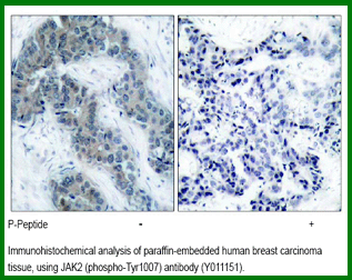 Anti-JAK2 (Phospho-Tyr1007)