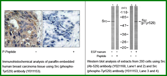 Anti-Src(Phospho-Tyr529)