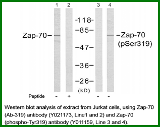 Anti-Zap-70 (Phospho-Tyr319)