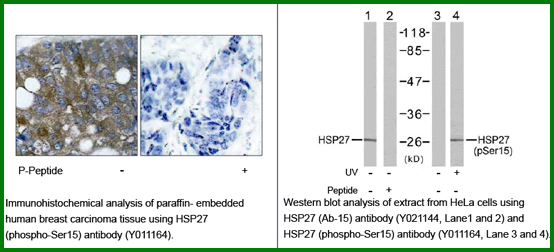 Anti-HSP27 (Phospho-Ser15)