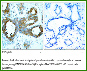 Anti-PAK1/PAK2/PAK3 (Phospho-Thr423/Thr402/Thr421)