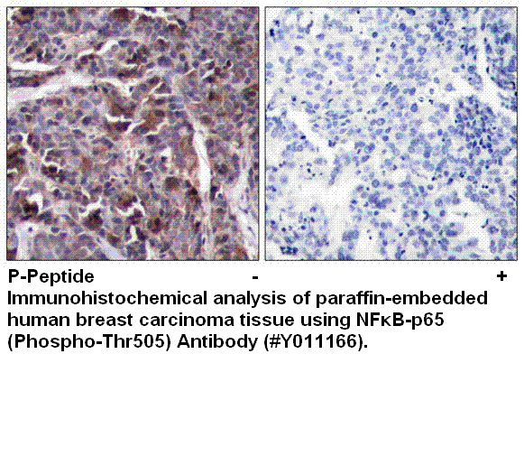 Anti-NF&kappa;B-p65 (Phospho-Thr505)