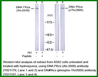 Anti-DNA PKcs (Phospho-Thr2609)