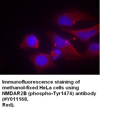 Anti-NMDAR2B (Phospho-Tyr1474)
