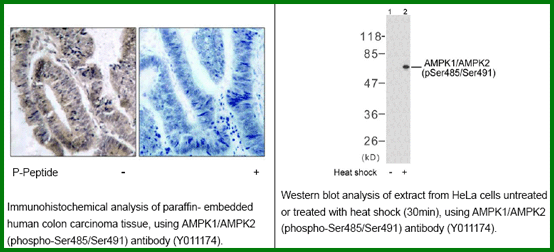 Anti-AMPK1/AMPK2 (Phospho-Ser485/Ser491)