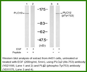 Anti-PLC&gamma;2 (Phospho-Tyr753)