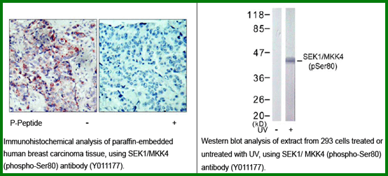 Anti-SEK1/MKK4 (Phospho-Ser80)