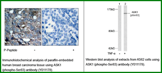 Anti-ASK1(Phospho-Ser83)