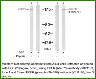 Anti-EGFR (Phospho-Thr678)