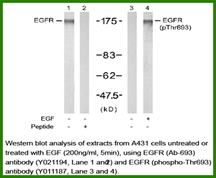 Anti-EGFR (Phospho-Thr693)