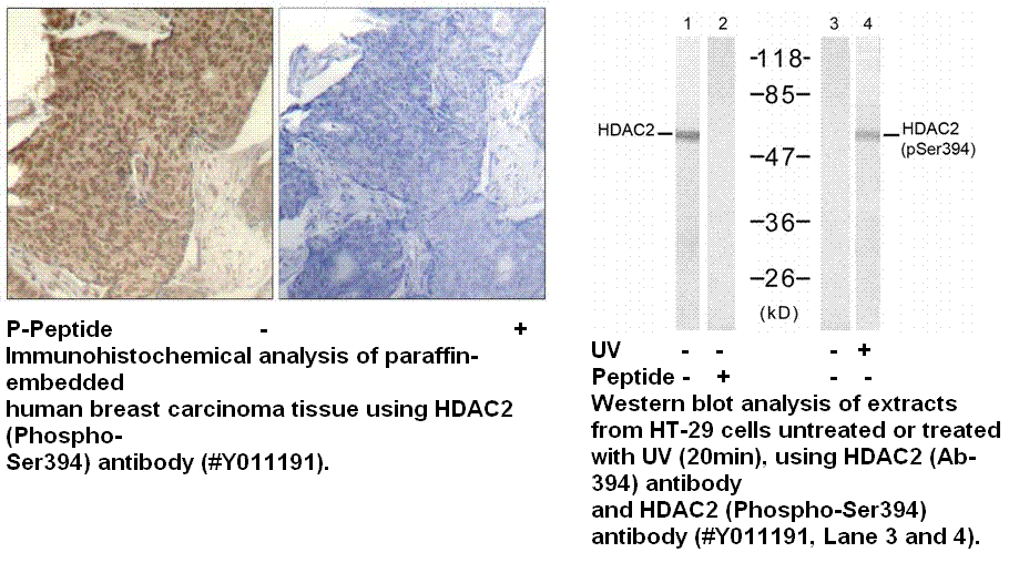 Anti-HDAC2 (Phospho-Ser394)