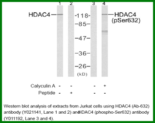 Anti-HDAC4 (Phospho-Ser632)