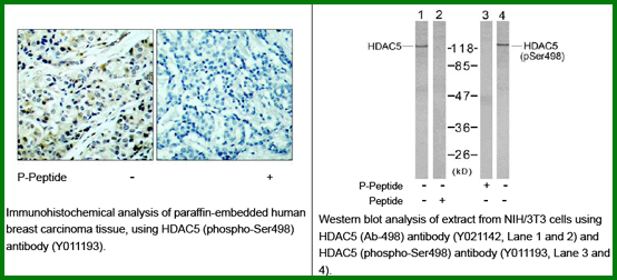 Anti-HDAC5 (Phospho-Ser498)