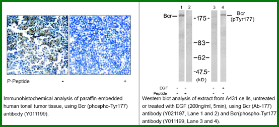 Anti-Bcr (Phospho-Tyr177)