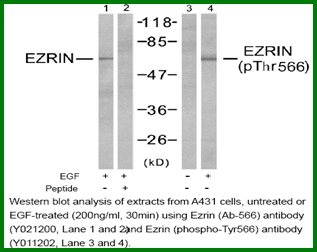 Anti-Ezrin (Phospho-Thr566)