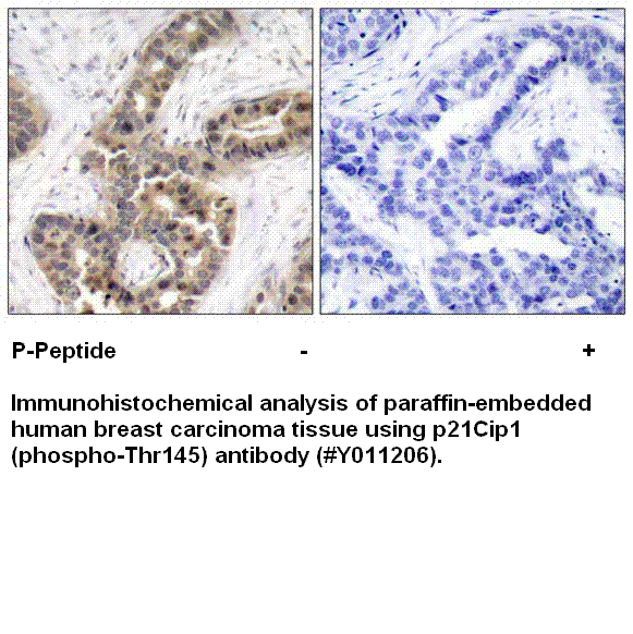 Anti-p21Cip1 (Phospho-Thr145)