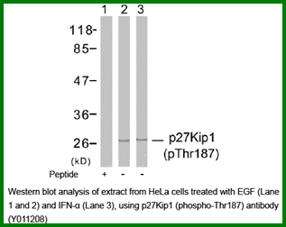 Anti-p27Kip1 (Phospho-Thr187)