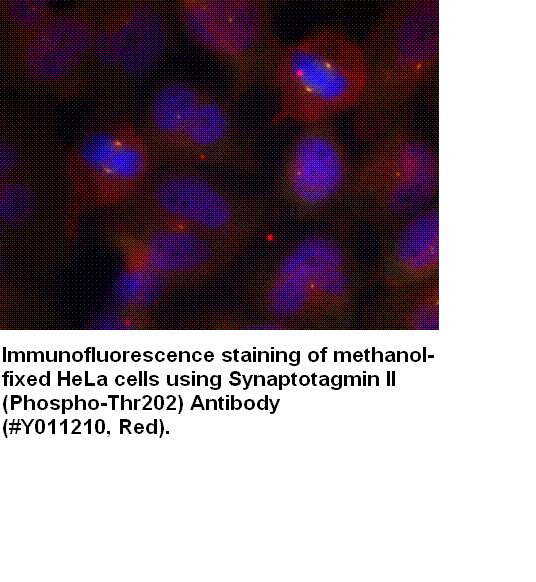 Anti-Synaptotagmin II (Phospho-Thr202)