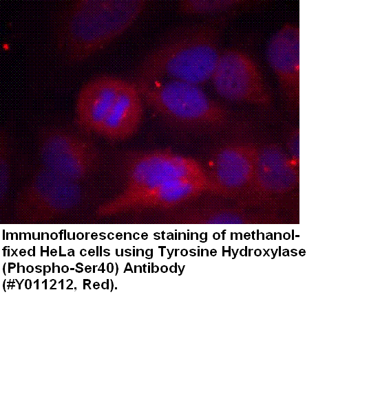 Anti-Tyrosine Hydroxylase (Phospho-Ser40)