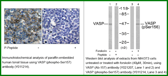 Anti-VASP (Phospho-Ser157)