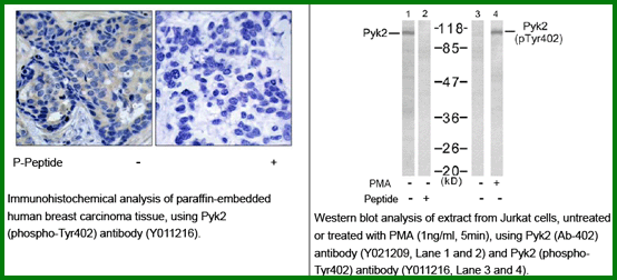 Anti-Pyk2 (Phospho-Tyr402)