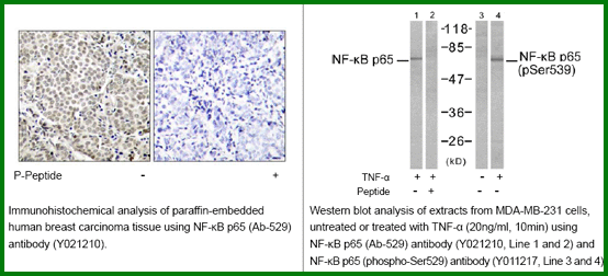 Anti-NF-kB p65 (Phospho-Ser529)