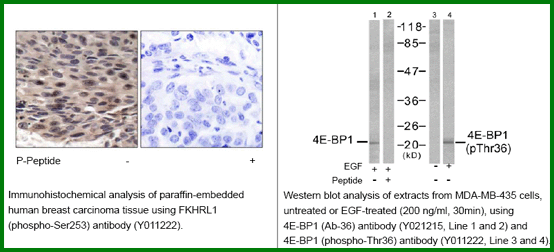 Anti-4E-BP1(Phospho-Thr36)