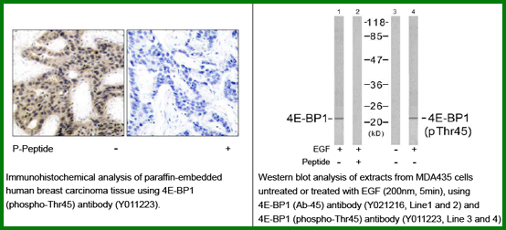 Anti-4E-BP1(Phospho-Thr45)
