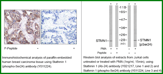 Anti-Stathmin 1 (Phospho-Ser24)