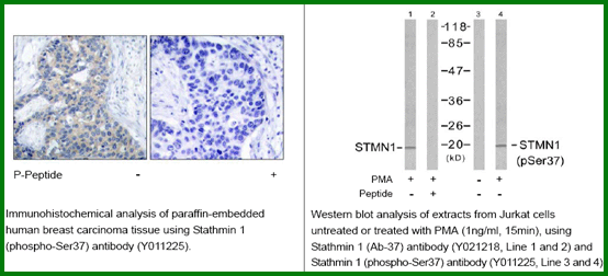 Anti-Stathmin 1 (Phospho-Ser37)