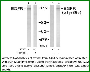 Anti-EGFR (Phospho-Tyr869)