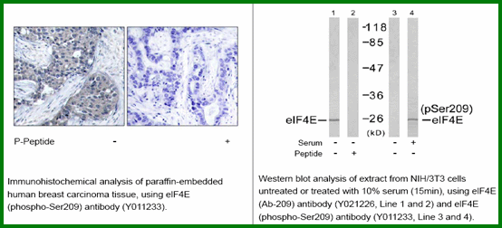 Anti-elF4E (Phospho-Ser209)