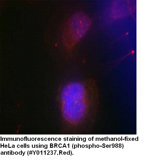 Anti-BRCA1 (Phospho-Ser988)