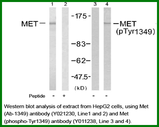 Anti-Met (Phospho-Tyr1349)