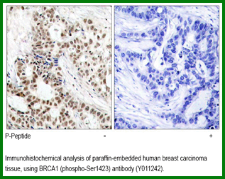 Anti-BRCA1 (Phospho-Ser1423)
