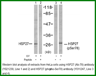 Anti-HSP27 (Phospho-Ser78)