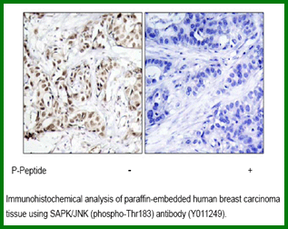 Anti-SAPK/JNK (Phospho-Thr183)