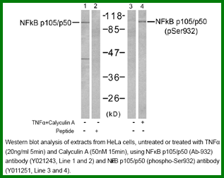 Anti-NF-kB p105/p50 (Phospho-Ser932)