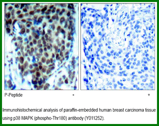 Anti-p38 MAPK (Phospho-Thr180)