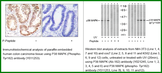 Anti-p38 MAPK (Phospho-Tyr182)