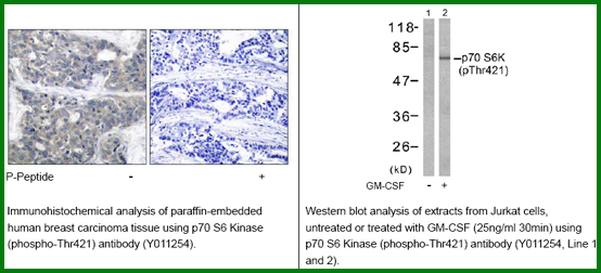 Anti-p70 S6 Kinase (Phospho-Thr421)