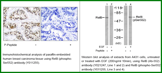 Anti-RelB (Phospho-Ser552)