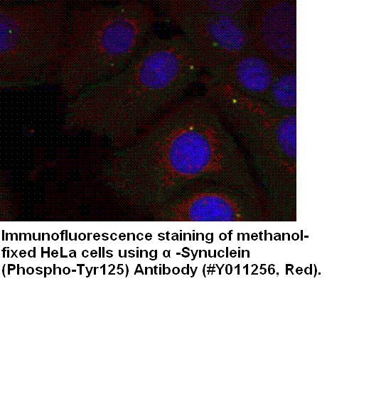 Anti-&szlig;-Synuclein (Phospho-Tyr125)