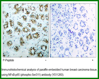 Anti-NF-&kappa;B p65 (phospho-Ser311)