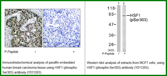 Anti-HSF1 (Phospho-Ser303)
