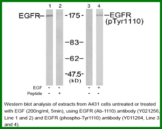 Anti-EGFR (phospho-Tyr1110)
