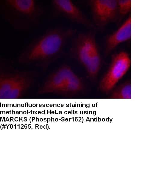 Anti-MARCKS (Phospho-Ser162)