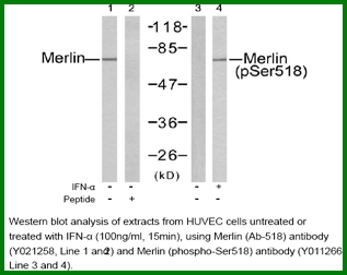 Anti-Merlin (Phospho-Ser518)