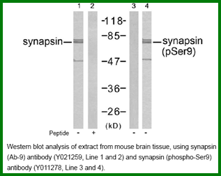 Anti-Synapsin (Phospho-Ser9)