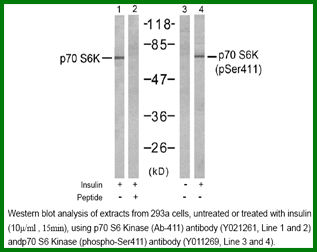 Anti-p70 S6 Kinase (Phospho-Ser411)